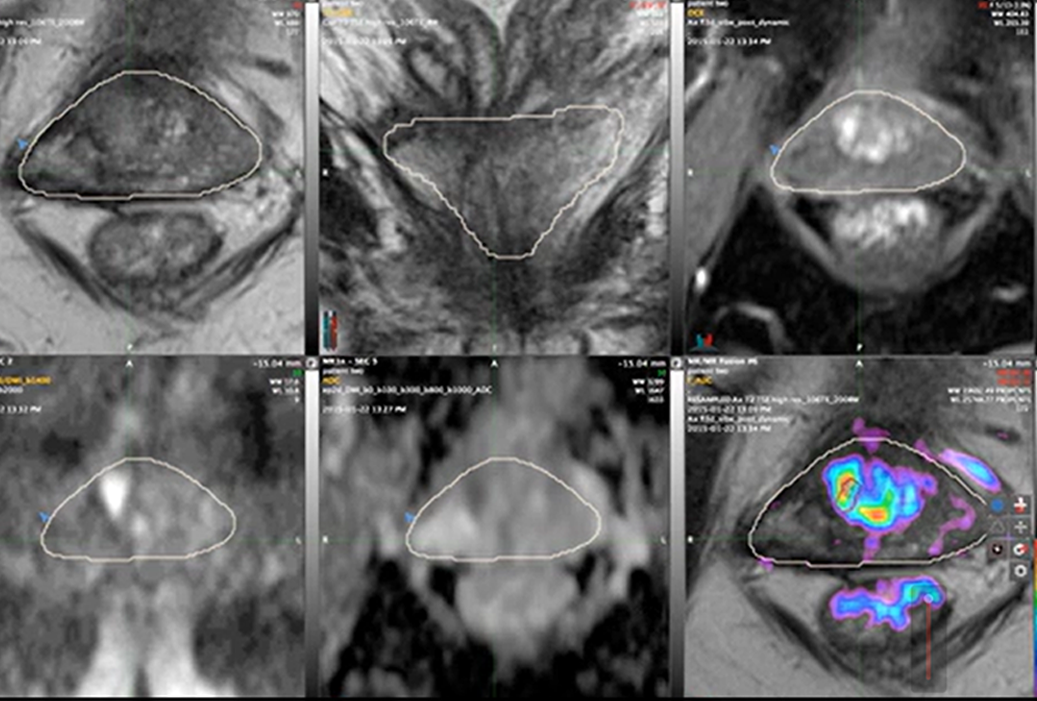Multiparametric MRI View 1