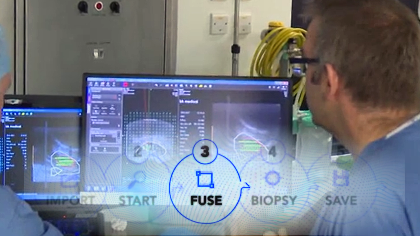 MRI fusion planning showing needle path visualization and target contouring