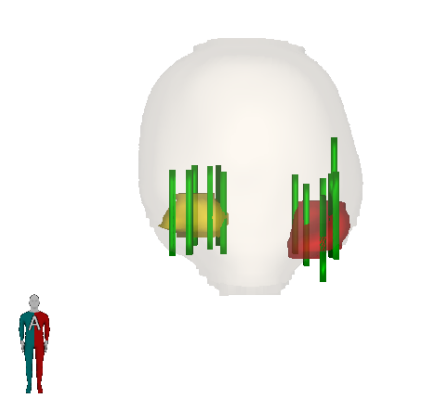 3D Biopsy Visualization 5