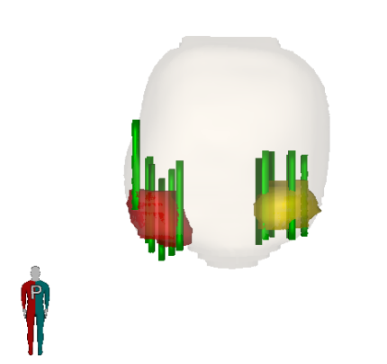 3D Biopsy Visualization 3