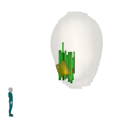 3D Biopsy Visualization 4